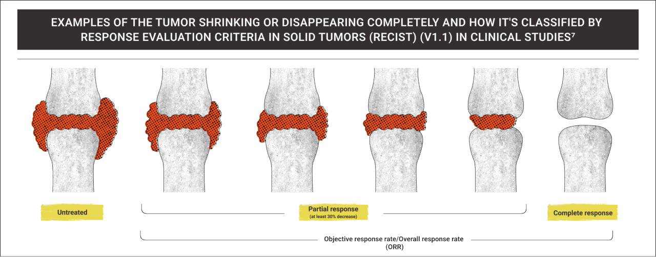 Possible changes that can happen over time  and how they are classified in clinical studies7